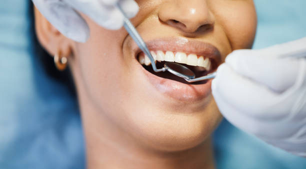 Best Broken or Cracked Tooth Emergency Dentist in Fort Dix, NJ